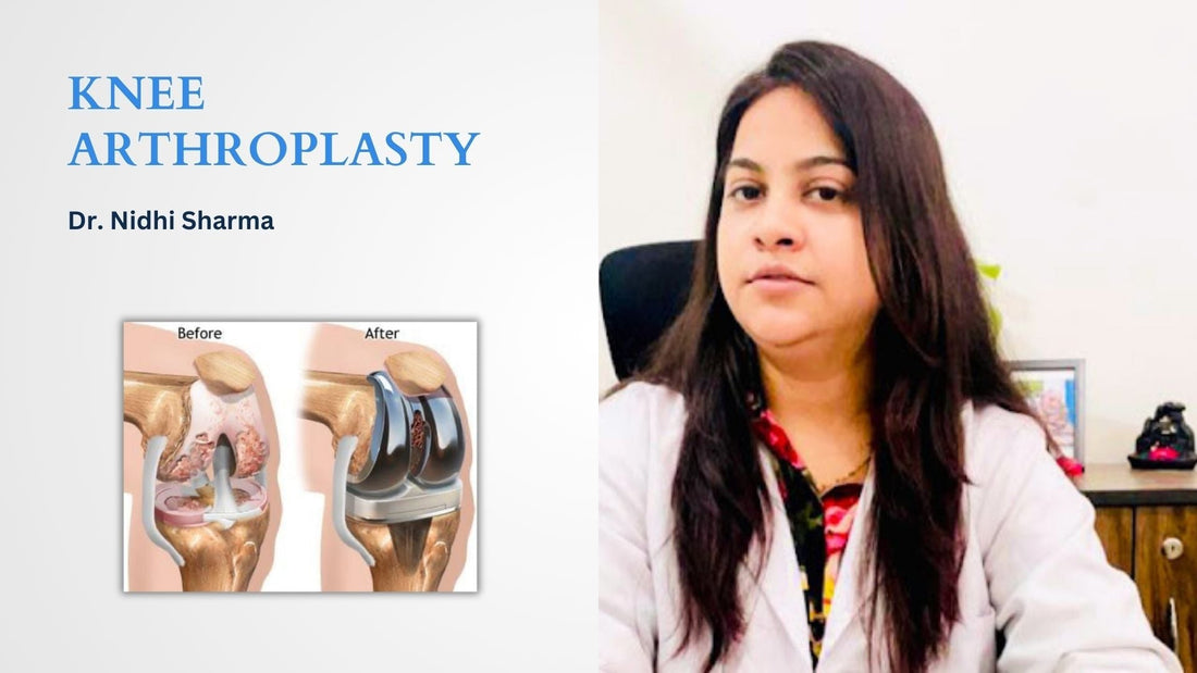 Total Knee Replacement: Recovery & Physiotherapy After Surgery