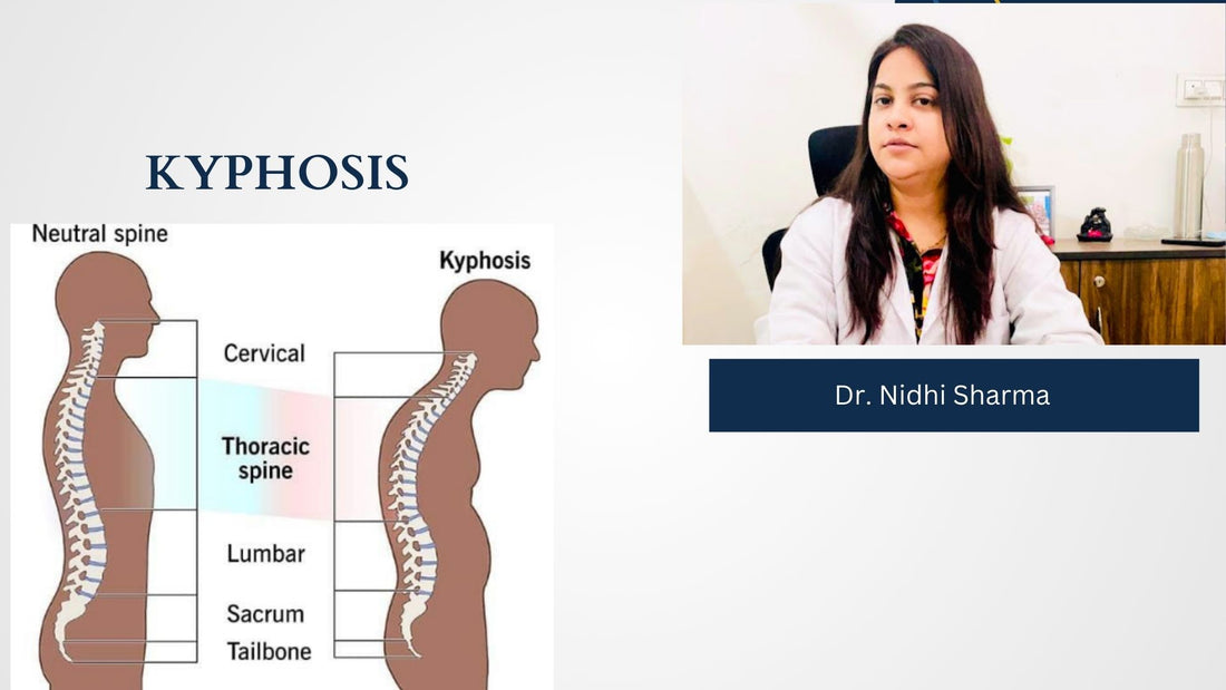 KYPHOSIS