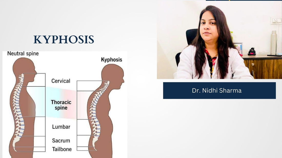 Kyphosis: Causes, Symptoms and Physiotherapy Treatment